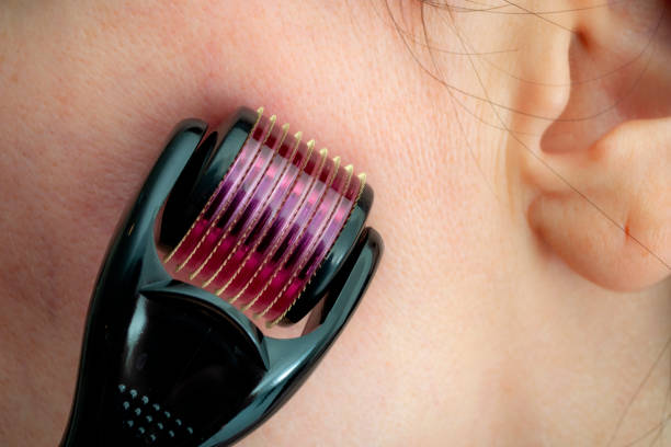 Classic Face Derma Rollers